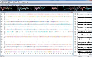 Power1401-3A Real Time Data Acquisition System