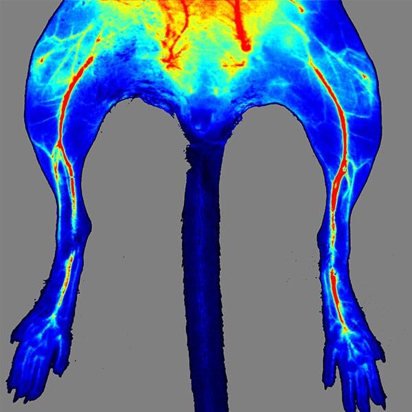 Digital image of a torso produced by the Laser Speckle Contrast Imaging System