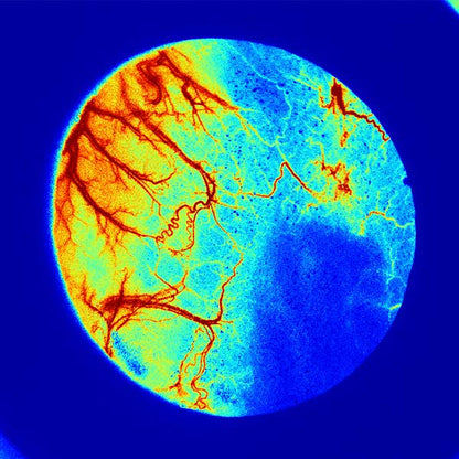 Digital circular image produced by the Laser Speckle Contrast Imaging System