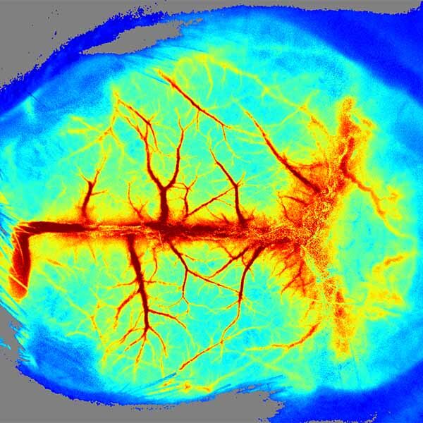 Digital image of a brain produced by the Laser Speckle Contrast Imaging System