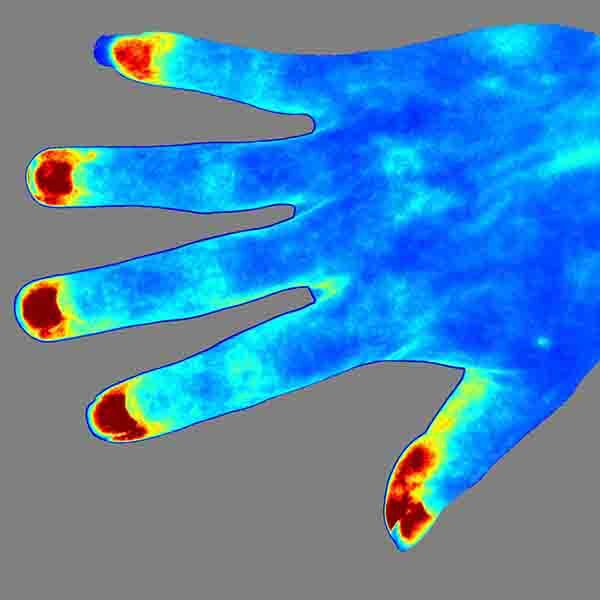 Digital image of a hand produced by the Laser Speckle Contrast Imaging System